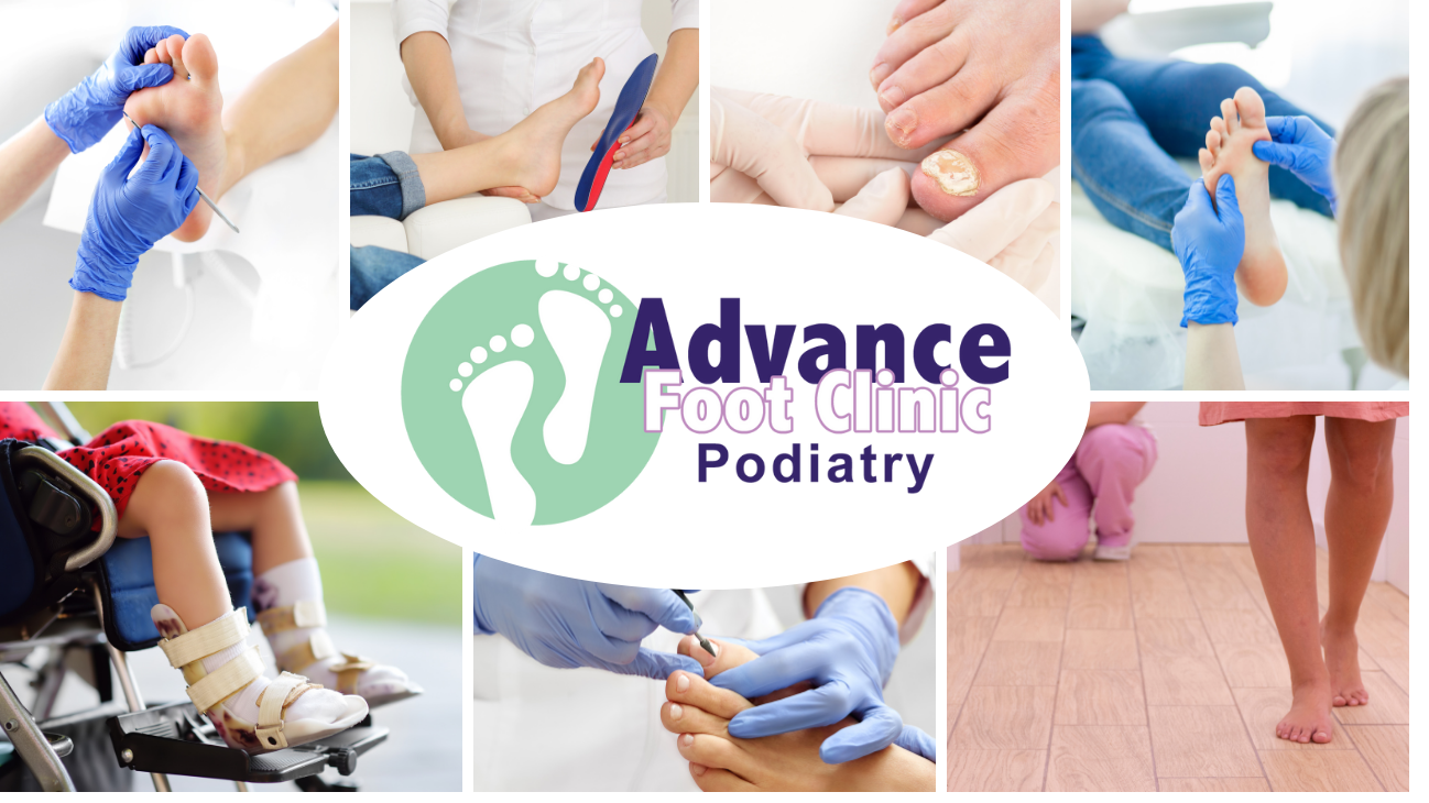 Advance Foot Clinic